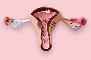 Hysterectomy Doctor in jaipur