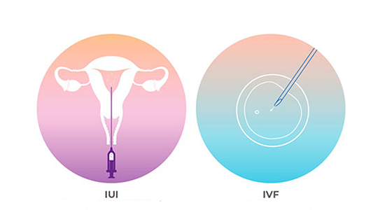 iui-ivf treatment