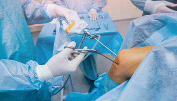 Arthroscopic Ligament Surgery